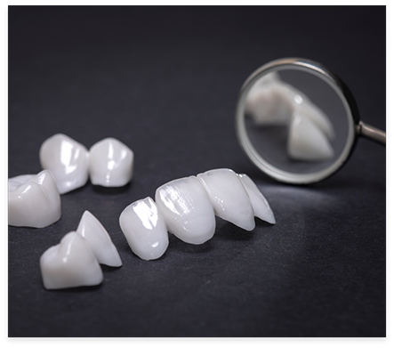 Several dental veneers on table next to dental mirror