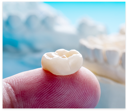 Close up of a dental crown resting on a finger