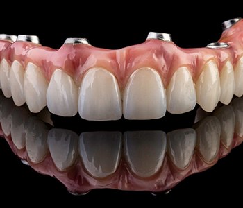 An implant denture