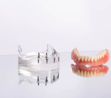 Man in dental chair smiling at reflection in handheld mirror