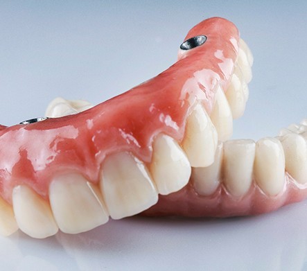 Hands of dentist and patient at desk looking over model teeth
