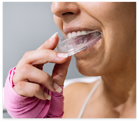 Person placing a clear mouthguard over their teeth