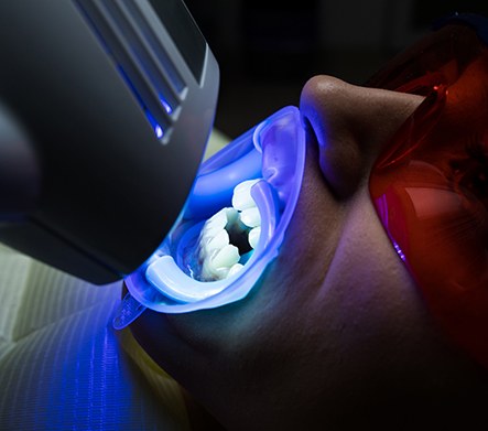 Patient receiving in-office teeth whitening