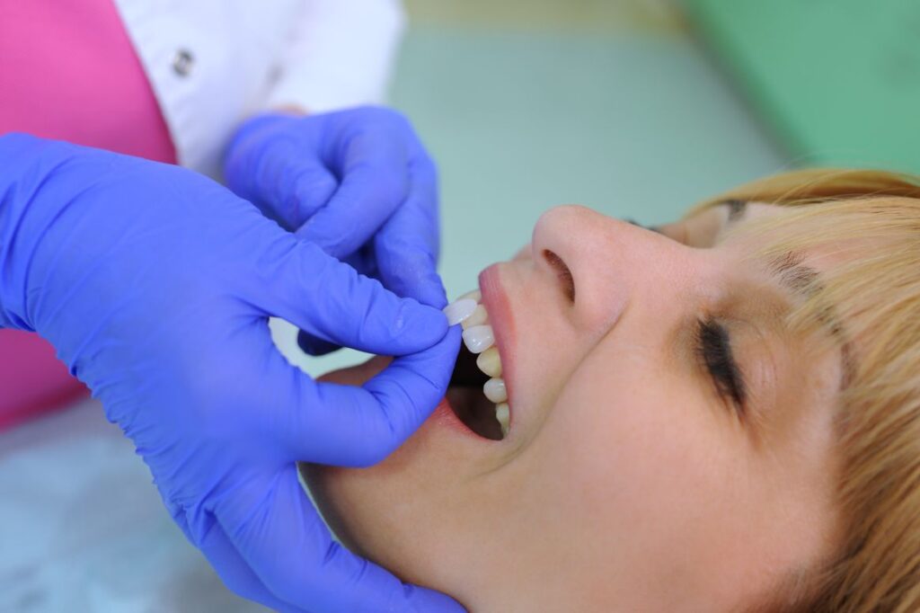 A woman getting veneers put on