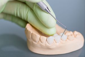 Green-gloved hand poking dental bridge on model teeth
