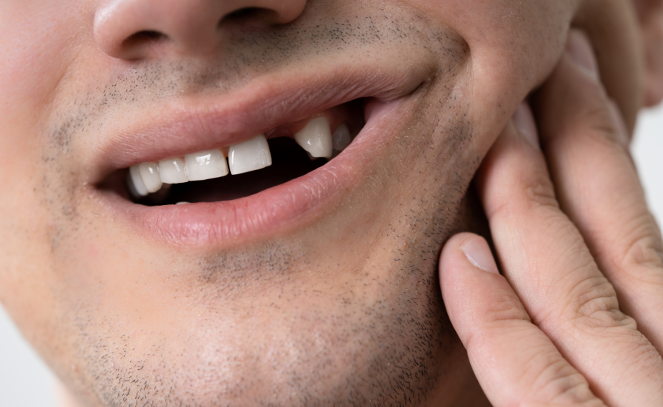 Close up of man's smile with missing tooth